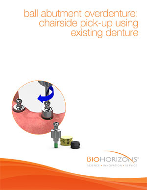 prothèse supradentaire de pilier-boule : pince de préhension de fauteuil en utilisant une prothèse dentaire existante